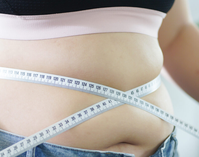 Person with measuring tape around her stomach to illustrate bariatric surgery weight loss