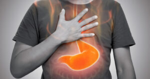 Illustration with a man holding his hand to his chest and red stomach and throat to illustrate Is There Weight Loss After Linx Surgery.